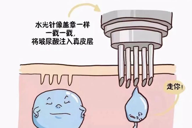 新手打水光应该怎么选？